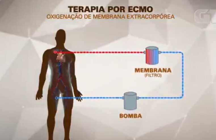 MC Marcinho usa terapia conhecida como ECMO, espécie de pulmão artificial; entenda como funciona